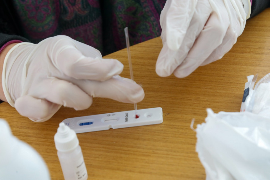 Projeto aprovado regulamenta a oferta de testes rápidos de covid-19 em farmácias do Paraná.