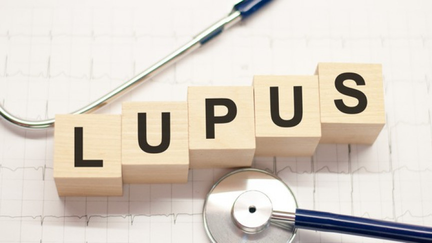 Lúpus é uma doença crônica inflamatória de origem autoimune.