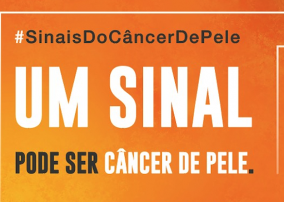 O verão se aproxima e é hora de aumentar os cuidados para evitar o câncer de pele