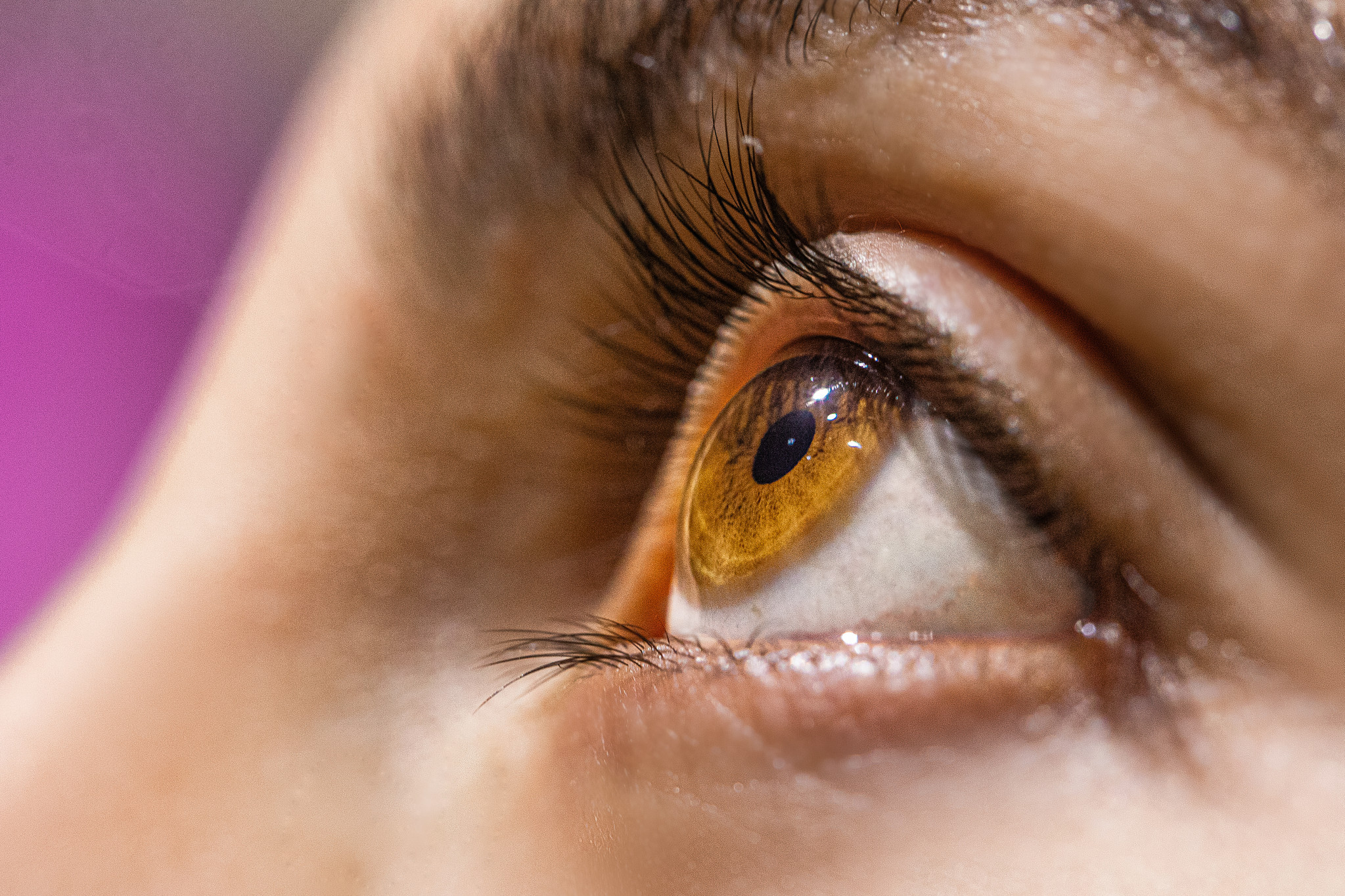 Isolamento social também trouxe consequências para a saúde dos olhos