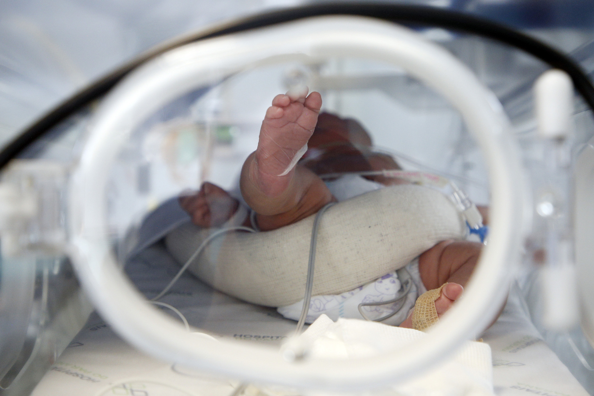 CCJ: aprovado projeto para melhorar tratamento de crianças com doenças no coração