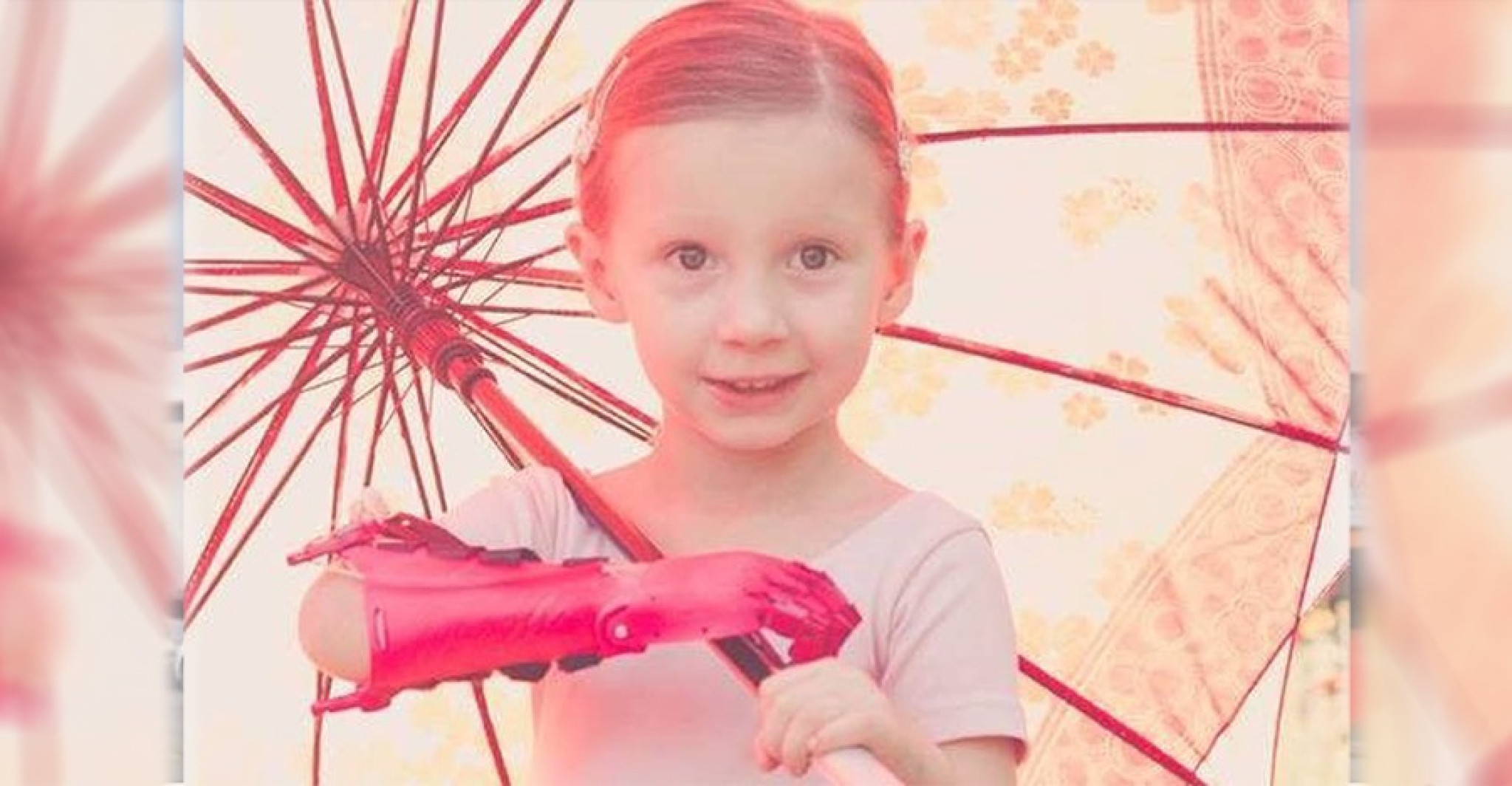 No Paraná, agenesia de membros tem dia de conscientização para redução das desigualdades