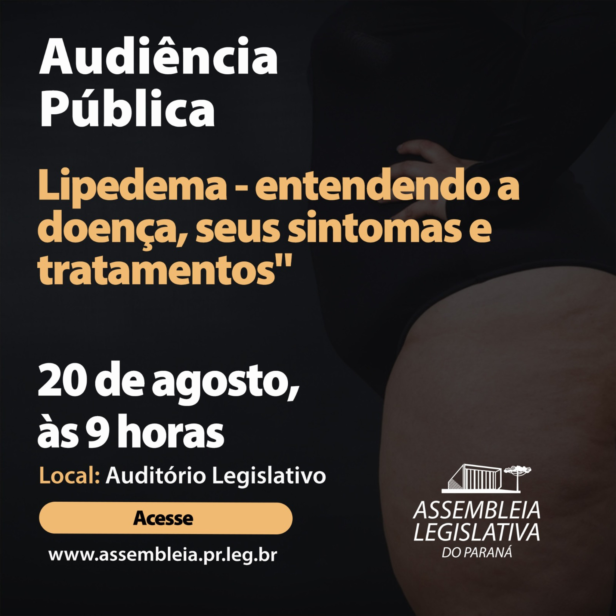 Especialistas vão debater na Assembleia os sintomas e tratamentos do lipedema