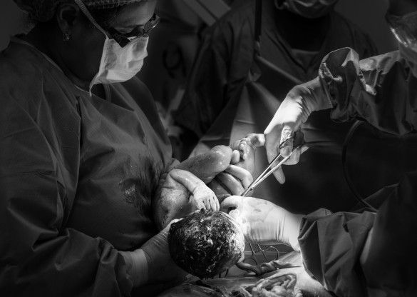 Projeto prevê presença de enfermeiras obstetras em todas as maternidades da rede pública e privada do estado