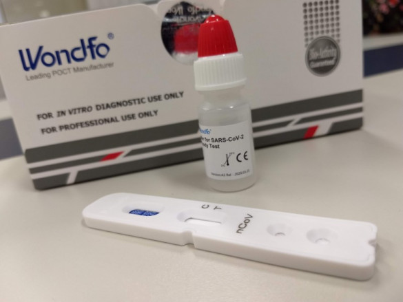 Paraná já recebeu mais de 57 mil testes rápidos de Covid-19