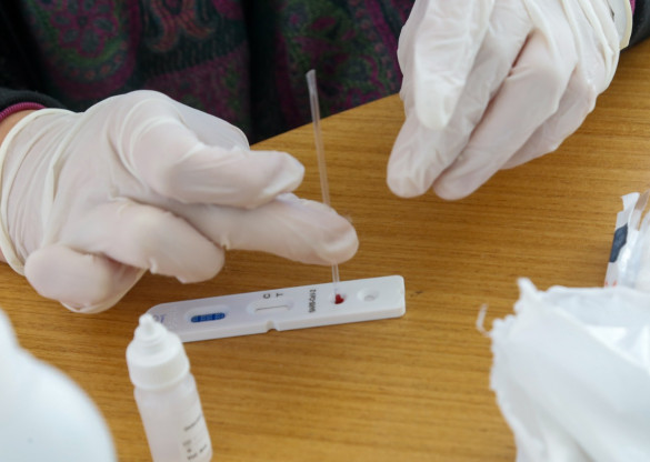 Projeto que regulamenta testes de covid-19 em farmácias é aprovado na Assembleia
