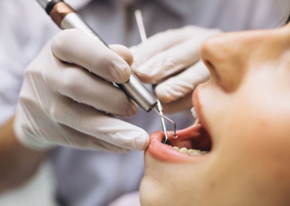 Chances de cura do câncer bucal são de mais de 90%, se doença for descoberta em fase inicial